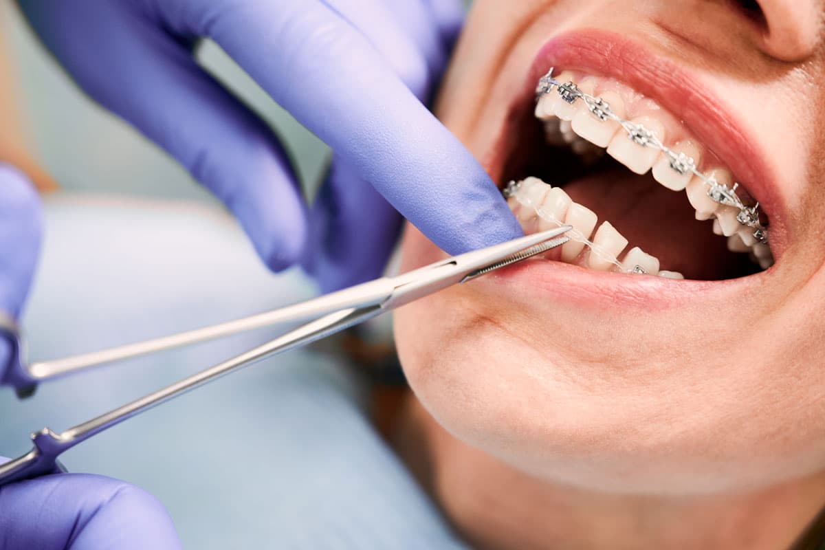 Dentistas especializados en Ferrol